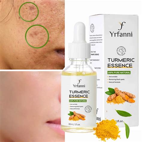 Turmeric Freckle Whitening Serum Dark Spot Correction Essential Oil