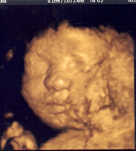 3d and 4d ultrasound pictures baby face - lerrilo