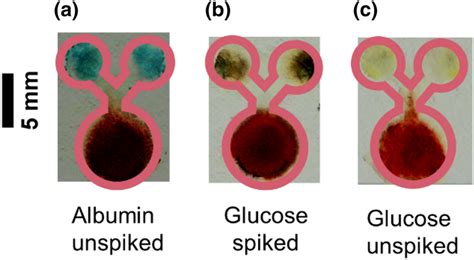 Colorimetric Detection Of Glucose And Albumin In Whole Blood Sample A