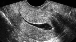 Gynecology Ultrasound - SMC OB-GYNE ULTRASOUND CLINIC