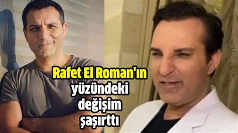 Rafet El Roman neden gündemde yüzüne ne oldu Hürsöz Gazetesi