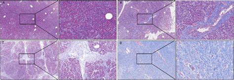 Massons Trichrome Staining Of Pancreatic Fibrosis With Scale Bar