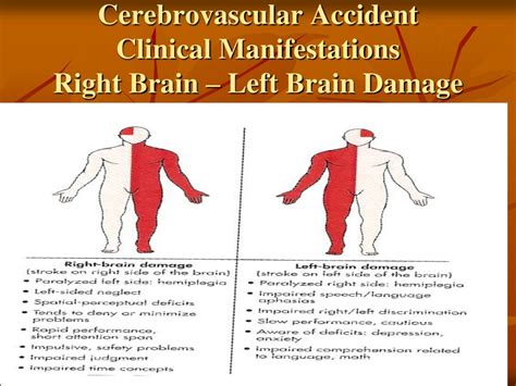 PPT Cerebrovascular Accident CVA PowerPoint Presentation Free