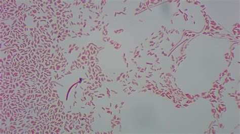 E Coli Gram Stain Morphology