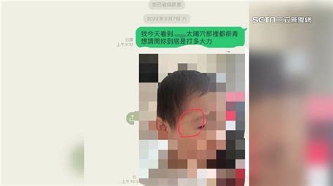 新北幼兒園施暴「她是累犯」！童被打到瘀青 曾親筆歉：不該動手 社會 三立新聞網 Setncom