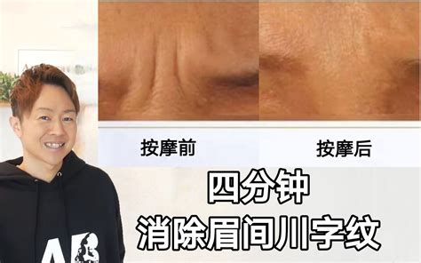 简单又实用，四分钟消除眉间川字纹及鼻子两侧的皱纹 哔哩哔哩 Bilibili