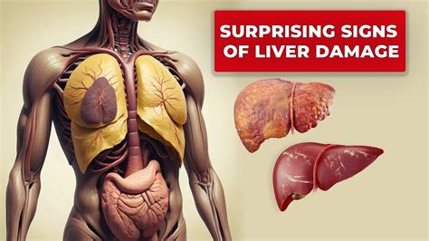 Your Liver Is Screaming 12 Surprising Signs Of Liver Damage Youtube