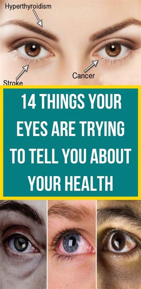 14 Things Your Eyes Are Trying To Tell You About Your Health