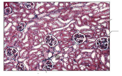 renal cortex tissue diagram quizlet