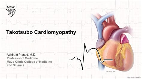 Takotsubo Cardiomyopathy YouTube