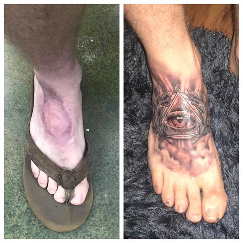 Tattoo Artist Specializing In Scar Cover Up Near Me Delinda Naylor