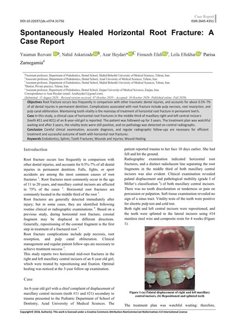 Pdf Spontaneously Healed Horizontal Root Fracture A Case Report