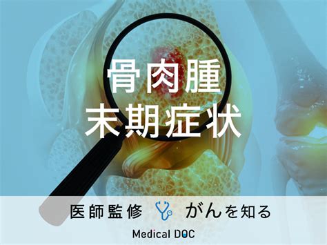 「骨肉腫の末期症状」はご存知ですか？ステージ・検査・治療法も解説！【医師監修】 メディカルドック