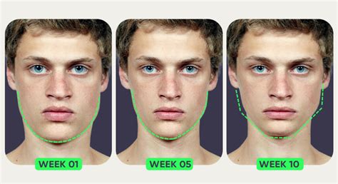 Does Mewing Change Your Face Shape and How? | Mewing.coach 