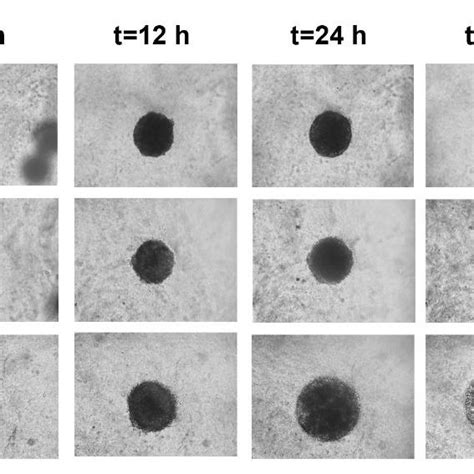 Representative phase-contrast microscopy images showing the ...