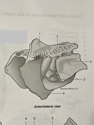 Ethmoid Sphenoid Mandible And Sinuses Flashcards Quizlet