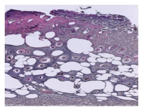 CD31 Immunostaining Of Burned Skin From Mice Untreated A Or Treated