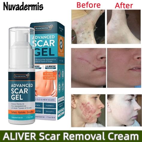 Advanced Scar Gel Acne Scars Treatment Scar Removal Cream Acne Scar