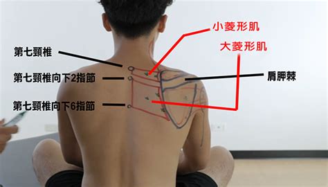 【按摩槍五分鐘上手】菱形肌放鬆 Str 運動癒防平台 幫你找到最適合的運動醫療專業人士資訊平台