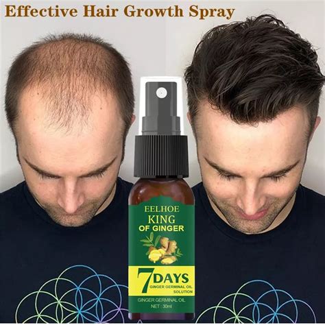 30mlhair Growth Essence Germinal Serum Essence Oil Natural Hair Loss Treatement Effective Fast