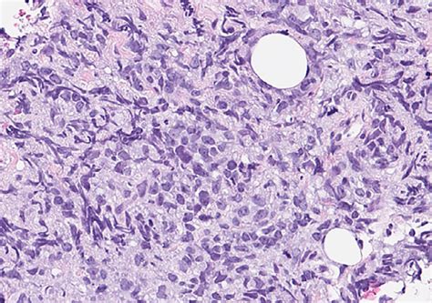 Histopathology Slide Biopsy Download Scientific Diagram