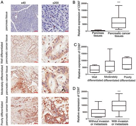 Expression And Prognostic Value Of CD97 And Its Ligand CD55 In