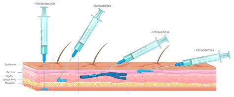 Infusion Por V A Subcut Nea V S V A Intravenosa