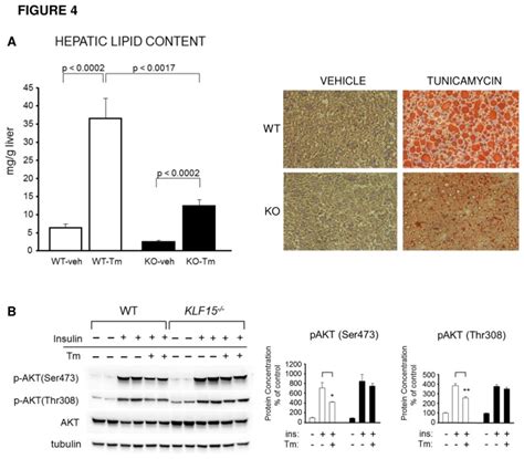 A Hepatic Lipid Accumulation In Response To Tunicamycin Treatment In