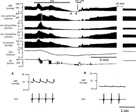 Example Of The Effects Of Epinephrine Administered Following Kcn