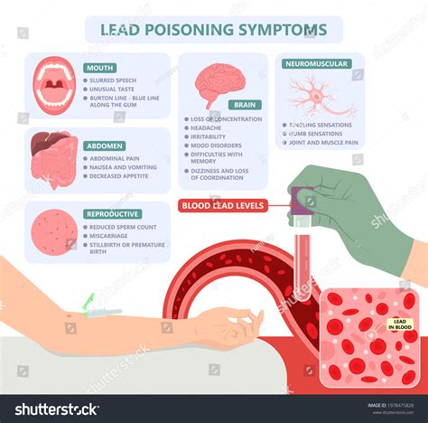 Toxic Effects Of Lead Images Stock Photos Vectors Shutterstock