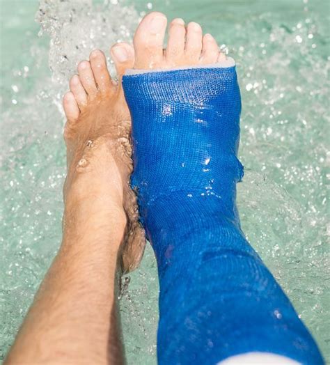 Waterproof Cast Padding It Cast Orthopedic Cast Waterproof Casts