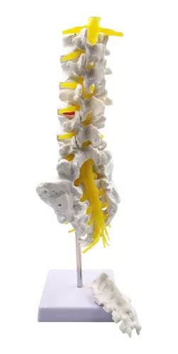 Modelo De Columna Vertebral Humana Juego De V Rtebras Lumb En Venta