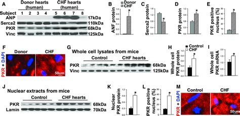 Double Stranded Rna Dependent Protein Kinase Pkr Expression And