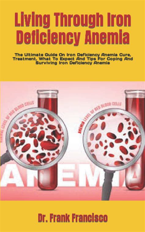 Buy Living Through Iron Deficiency Anemia The Ultimate Guide On Iron