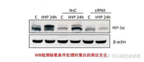 Western Blot 实验大忌——稀里糊涂跑内参蛋白 知乎