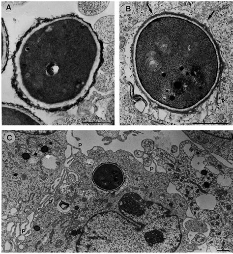 Transmission Electron Micrographs Of Human Umbilical Vein Ec Incubated