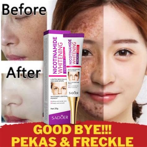 Nicotinamide Whitening Freckle Removing Cream Original Pekas Remover