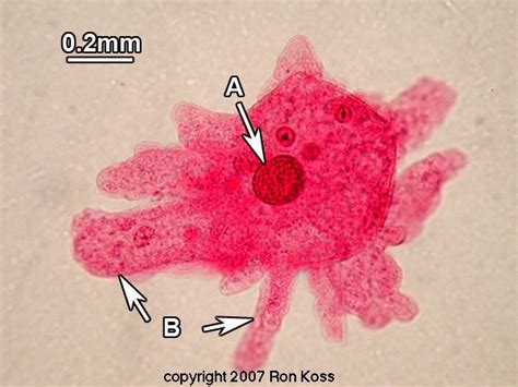 Amoeba Slide Labeled