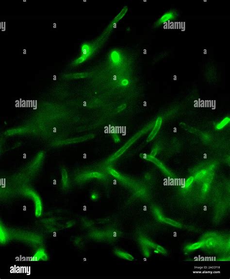 Anthrax Bacteria Fluorescent Light Micrograph Of Bacillus Anthracis