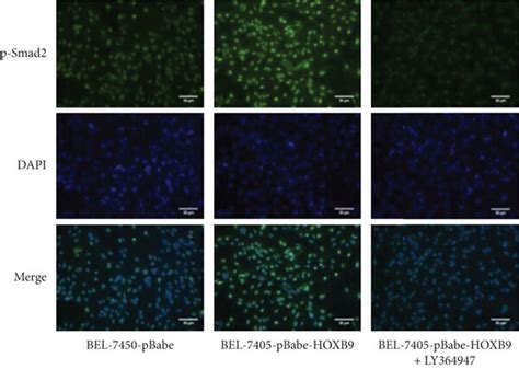 Tgf β1 Signaling Pathway Participates In The Role Of Hoxb9 In Hcc