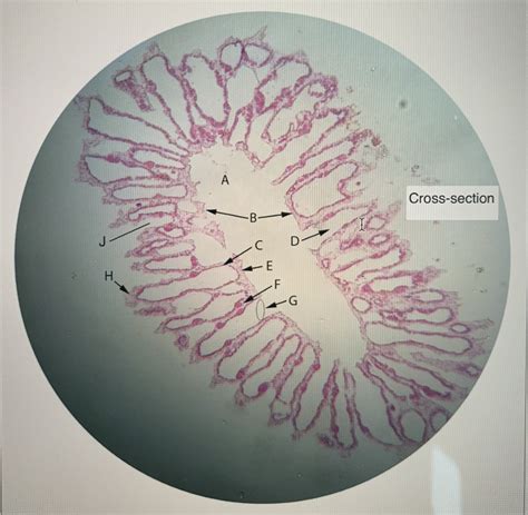 Diagram Porifera Lab Diagram Quizlet