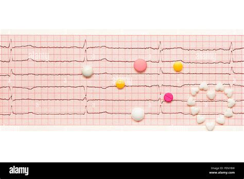 Myocardial Infarction Ecg Banque De Photographies Et Dimages Haute