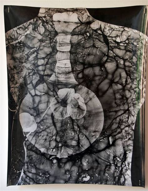 Photogram of Asthma Vessel (bubble lung in torso) - Limited Edition 1 ...