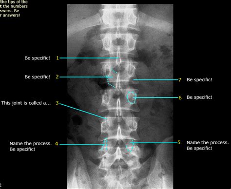 Abdomen Lumbar Spine AP View 2 Diagram Quizlet