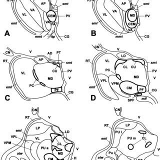 Mild Ad Related Immunopositive Cytoskeletal Changes In The Thalamic