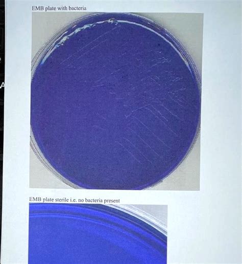 SOLVED: EMB plate with bacteria EMB plate sterile i.e. no bacteria present