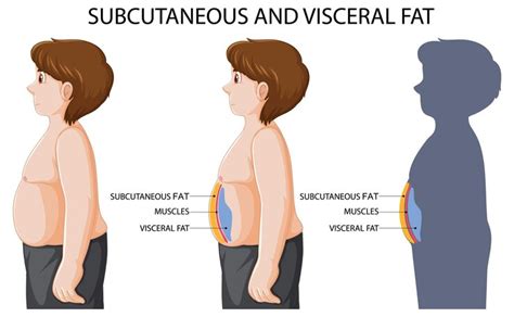 vector subcutaneous  visceral fat diagram