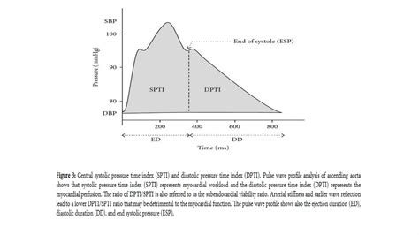 Iabp Troubleshooting Ppt