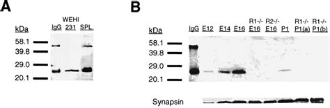 Western Blot Analysis Of Wild Type Fetal Brain Detects A 25 Kda Light