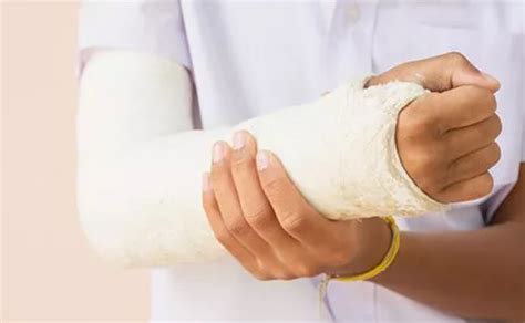 Care Of Casts & Splints